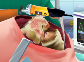 Knee Surgery Simulator